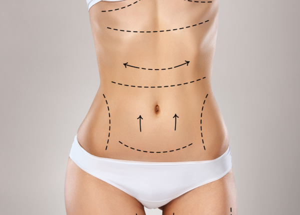 Abdominoplastia con Reparación Muscular + Lipoescultura + BBL